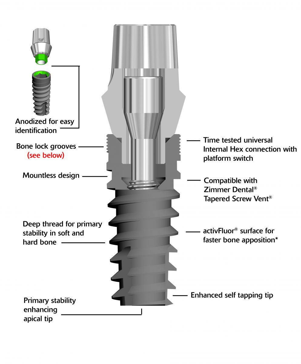 BIO Internal Hex Advantages Blue Sky Bio